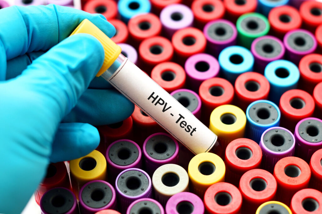 hpv-test