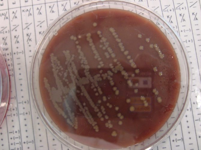 group b strep in pregnancy